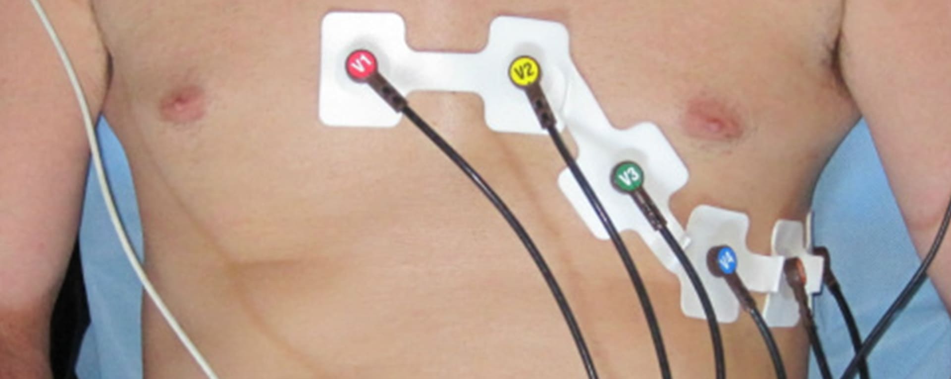 Electrocardiogram